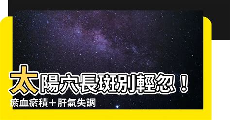 太陽穴長斑|【太陽穴長斑】太陽穴長斑大解密！背後竟藏著這可怕的健康警訊？